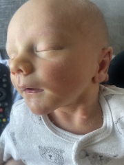 what's this spot on my baby (with pics)