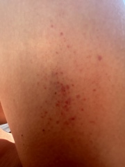 Why is my skin always like this? - pics