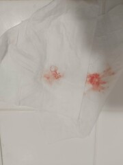 Bleeding ... again 😔 Pics added TMI