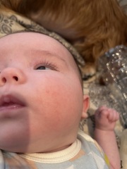 Newborn herpes / cold sore worry