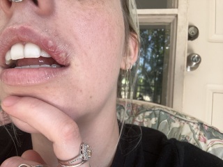 Compeed cold sore patches