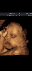 Due October 2023 Thread 8