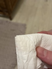 Implantation bleeding?