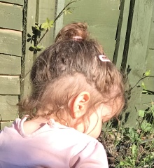 Hair loss/thinning (hairline/nape) in toddler