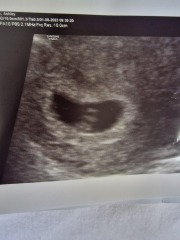 Early scan, twins?