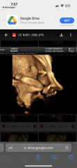 November 2023 babies - thread 4