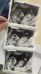 Any gender guesses from my 12 week scan?