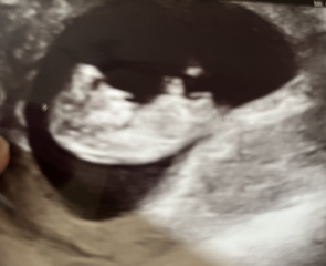 February 2024 Babies 👶 (thread 3)