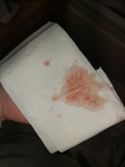 Implantation bleeding?