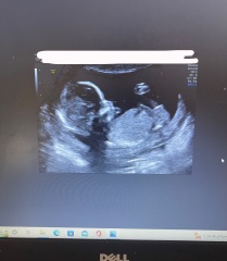 Does my 16 week gender scan look correct?