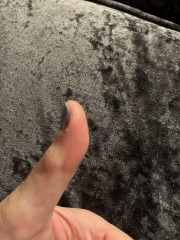 Is my thumb infected? Gross pic