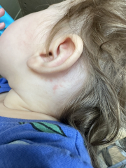 Please read panicking about chicken pox