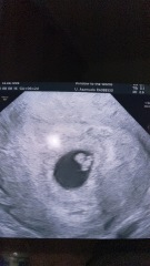 Successful scans at 6 weeks?