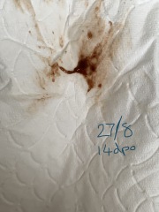 Pregnant or chemical pregnancy (& loss)?