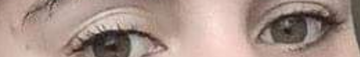Are my uneven eyelids obvious?