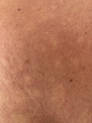 Why is my skin always like this? - pics