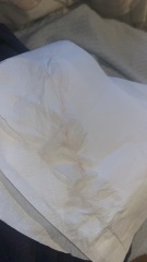 Clear discharge with pink in when I wipe