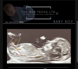 February 2024 Babies 👶 (thread 3)