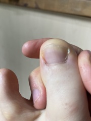 Dark line/mark near toe
