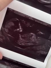 Boy or girl- Nub theory!