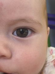What colour are my baby's eyes?