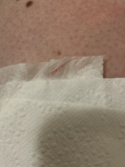 Implantation bleeding?
