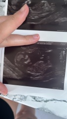 Boy or girl- Nub theory!
