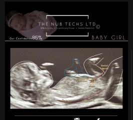 February 2024 Babies 👶 (thread 3)