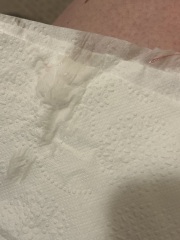 Implantation bleeding?