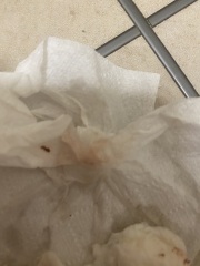 bleeding