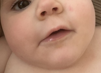 Please read panicking about chicken pox