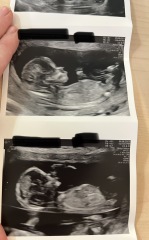 February 2024 Babies 👶 (thread 3)