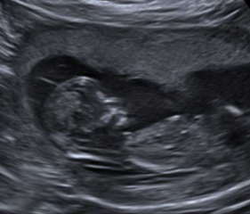 Place your random bets... nub/skull theory! 👶