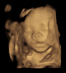 TWW - Testing Around 1st March 