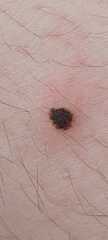 What is this on DD's leg and how urgently does it need looked at?