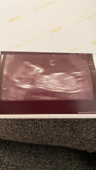 Does my scan look ok? Feeling anxious ftm