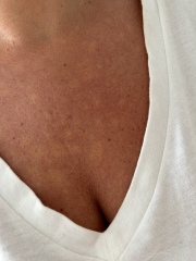 Why is my skin always like this? - pics