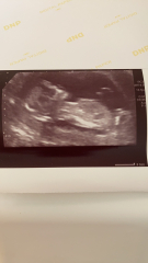 Does my scan look ok? Feeling anxious ftm
