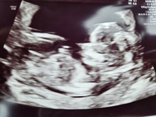 February 2024 Babies 👶 (thread 3)