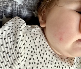 Please read panicking about chicken pox