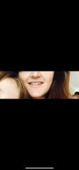Adult braces