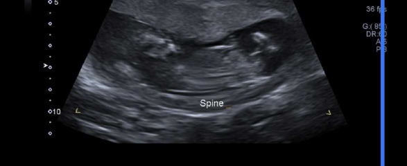 Place your random bets... nub/skull theory! 👶