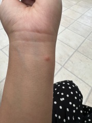 Evidence of Bed bugs needed
