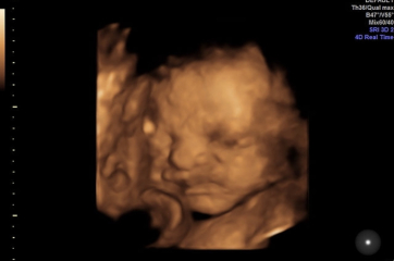 Due October 2023 Thread 8
