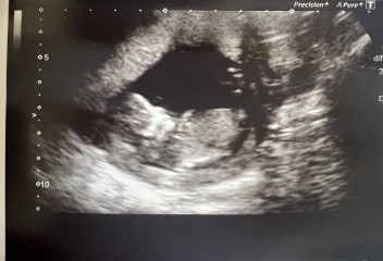 Nub theory guess for baby three