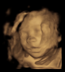 TWW - Testing Around 1st March 