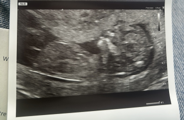 Pregnant after miscarriage - support thread NEW