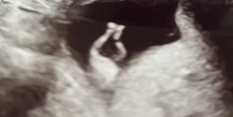 February 2024 Babies 👶 (thread 3)