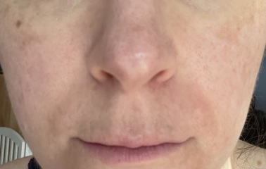 Can anyone help me get an even complexion??