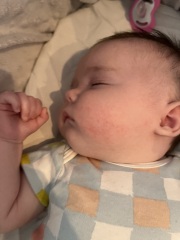 Newborn herpes / cold sore worry